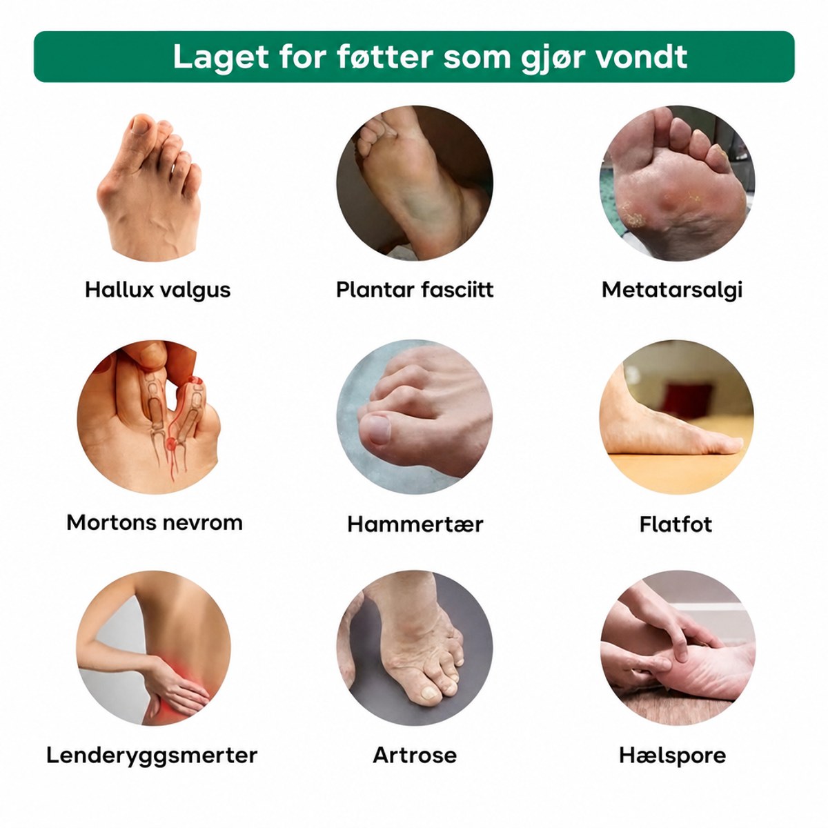 Passer for ulike fotplager